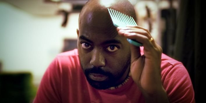 black man bald no hair hairloss